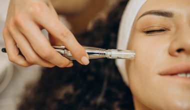 The “classic” microneedling glow: Why This treatment still wins in Beverly Hills