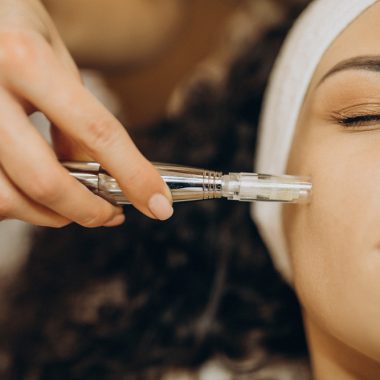 The “classic” microneedling glow: Why This treatment still wins in Beverly Hills
