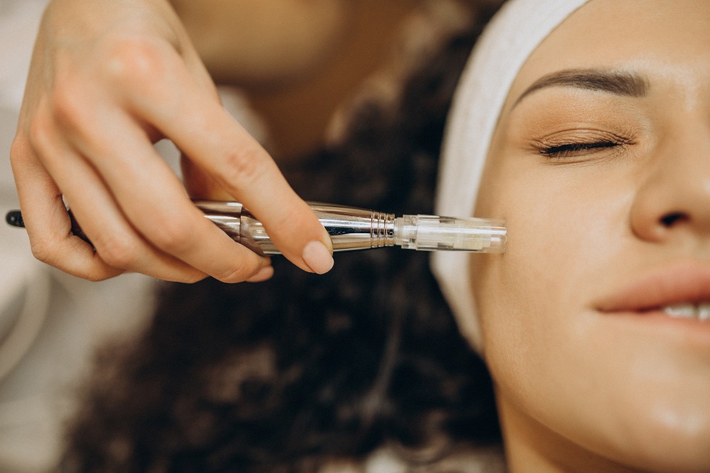 The “classic” microneedling glow: Why This treatment still wins in Beverly Hills